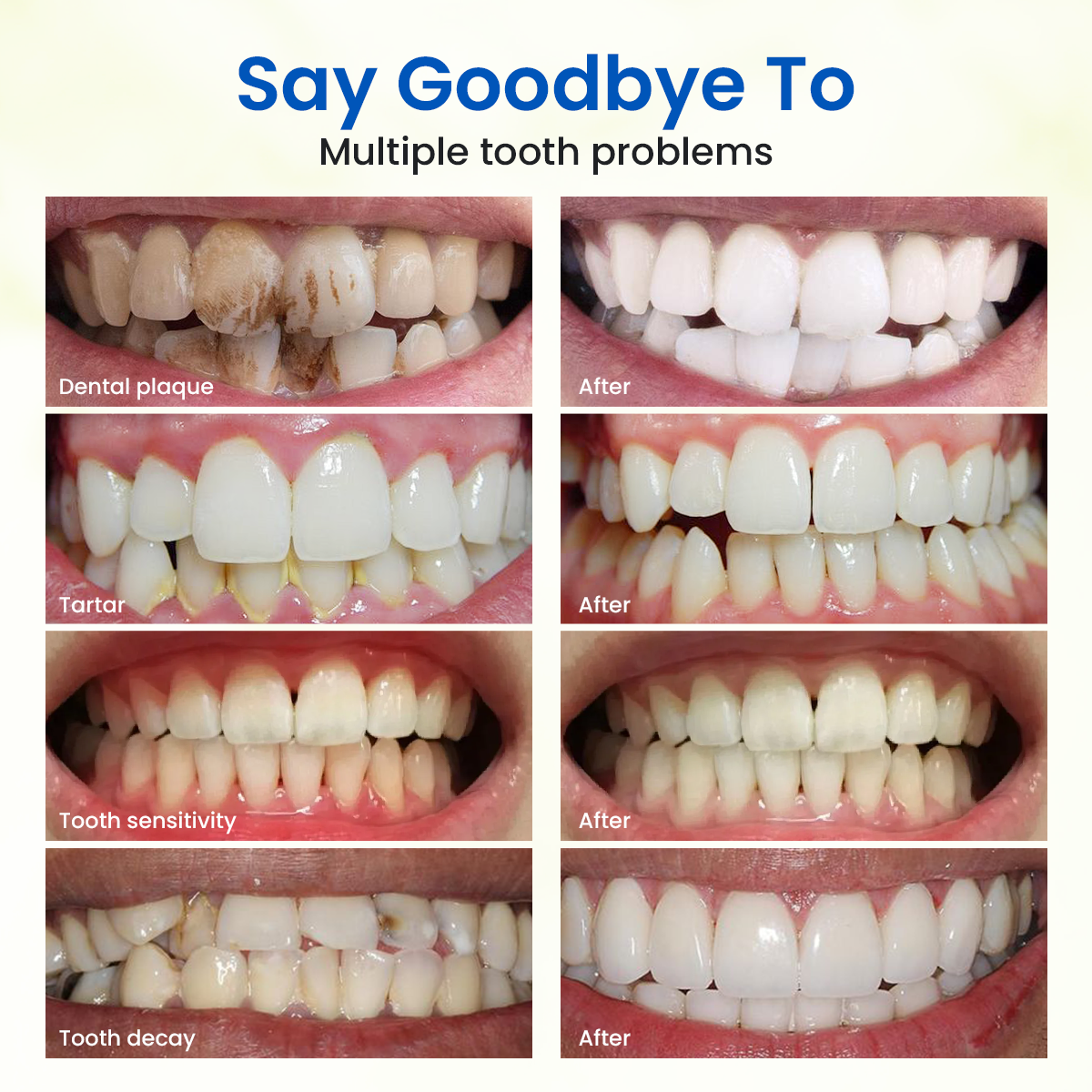 Freshmile Teeth Whitening Powder
