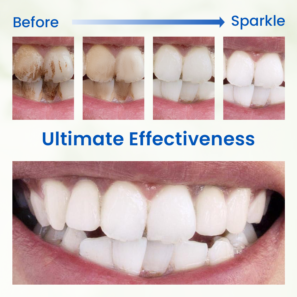 Freshmile Teeth Whitening Powder