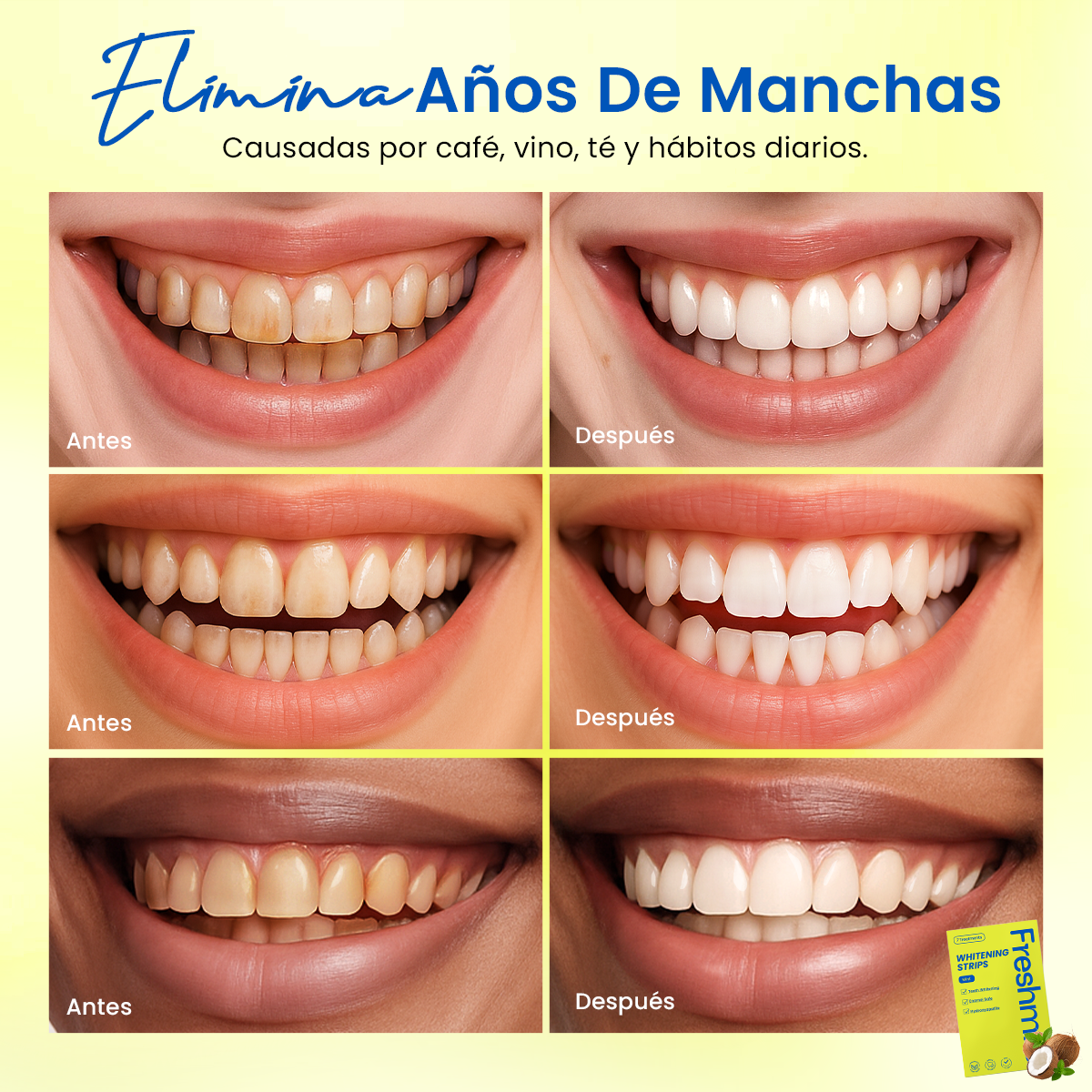 Freshmile Teeth Whitening Strips (7 Pairs)